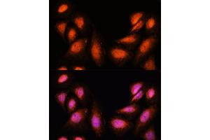 Immunofluorescence analysis of U-2 OS cells using SUPT6H antibody (ABIN7270645) at dilution of 1:100. (Spt6 antibody  (AA 1500-1726))