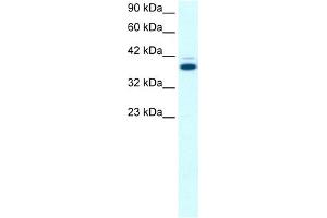 WB Suggested Anti-GABPB2 Antibody Titration:  0. (GABPB2 antibody  (C-Term))