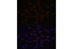 Immunofluorescence analysis of C6 cells using RGS4 antibody (ABIN7269898) at dilution of 1:100. (RGS4 antibody  (AA 1-100))