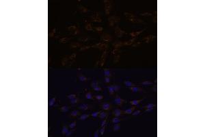 Immunofluorescence analysis of C6 cells using RGS4 antibody (ABIN7269898) at dilution of 1:100. (RGS4 antibody  (AA 1-100))