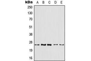 Western blot analysis of ARF4 expression in HeLa (A), HepG2 (B), mouse liver (C), mouse kidney (D), rat kidney (E) whole cell lysates. (ARF4 antibody  (Center))