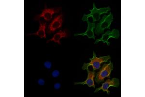 ABIN6258659 and ABIN6274961 staining Hela cells by IF/ICC.