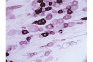 Immunohistochemical staining of Trpv2 in rat trigeminal ganglion using Trpv2 polyclonal antibody . (TRPV2 antibody  (AA 744-761))