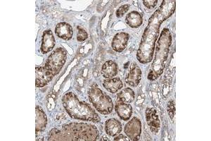Immunohistochemical staining of human kidney with FOXRED2 polyclonal antibody  shows strong cytoplasmic positivity in renal tubules.