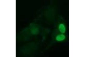 Image no. 2 for anti-Ubiquitin-Conjugating Enzyme E2S (UBE2S) antibody (ABIN1501646)