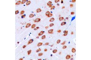 Immunohistochemical analysis of Kir3. (KCNJ9 antibody  (Center))