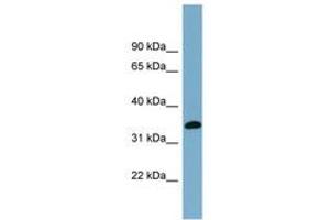 Image no. 1 for anti-Acyl-CoA Wax Alcohol Acyltransferase 1 (AWAT1) (AA 71-120) antibody (ABIN6743321) (AWAT1 antibody  (AA 71-120))