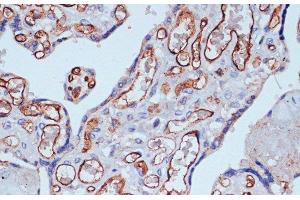 Immunohistochemistry of paraffin-embedded Human placenta using CD34 Polyclonal Antibody at dilution of 1:100 (40x lens). (CD34 antibody)