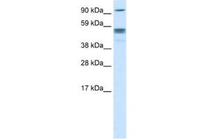 Western Blotting (WB) image for anti-Septin 4 (SEPT4) antibody (ABIN2463655)