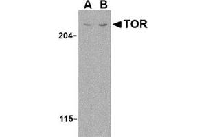 Western blot analysis of TOR in L1210 cell lysate with this product at (A) 1 and (B) 2 μg/ml. (MTOR antibody  (N-Term))