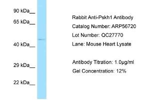 Western Blotting (WB) image for anti-Protein Serine Kinase H1 (PSKH1) (C-Term) antibody (ABIN2786862) (PSKH1 antibody  (C-Term))