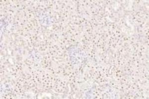 Immunohistochemistry analysis of paraffin-embedded rat kidney using,TORC1 (ABIN7073590) at dilution of 1: 800 (CRTC1 antibody)