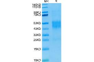 Human NKG2C/CD159c on Tris-Bis PAGE under reduced condition.
