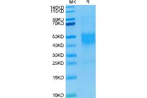 Human NKG2C/CD159c on Tris-Bis PAGE under reduced condition. (KLRC2 Protein (His-Avi Tag))