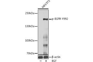 Western blot analysis of extracts of NIH/3T3 cells, using Phospho-EGFR-Y992 antibody (ABIN3019463, ABIN3019464, ABIN3019465 and ABIN6225385) at 1:1000 dilution. (EGFR antibody  (pTyr992))