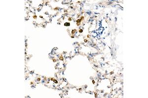 Immunohistochemistry of paraffin-embedded Rat lung using CD63 antibody (ABIN7266210) at dilution of 1:200 (40x lens). (CD63 antibody)