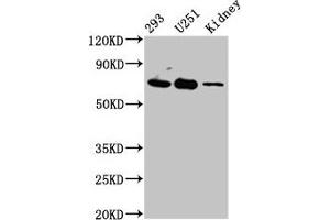 Western Blot Positive WB detected in: 293 whole cell lysate, U251 whole cell lysate, Rat kidney tissue All lanes: EOMES antibody at 4. (EOMES antibody  (AA 562-676))