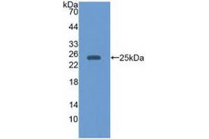 Western blot analysis of recombinant Human EBI3. (EBI3 antibody)