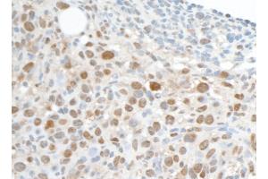 Immunohistochemistry (IHC) image for anti-Proliferating Cell Nuclear Antigen (PCNA) antibody (ABIN7453982) (PCNA antibody)