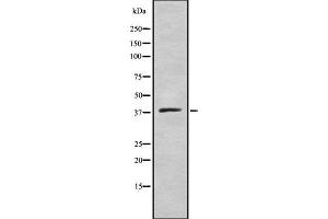 Western blot analysis of ELAV2/4 using COLO205 whole cell lysates (ELAV2/4 antibody)