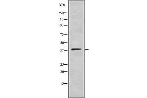 Western blot analysis of ELAV2/4 using COLO205 whole cell lysates (ELAV2/4 antibody)