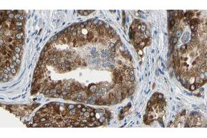 ABIN6273576 at 1/100 staining Human prostate tissue by IHC-P. (VSIG2 antibody  (Internal Region))