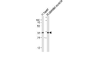 Western blot analysis of lysates from human heart and human skeletal muscle tissue lysate (from left to right), using DIO2 Antibody (Center) (ABIN652664 and ABIN2842445). (DIO2 antibody  (AA 165-191))