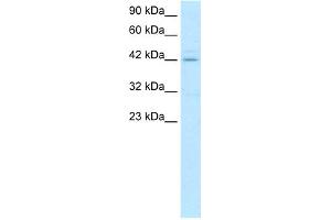 WB Suggested Anti-HOXA10 Antibody Titration:  0. (HOXA10 antibody  (N-Term))