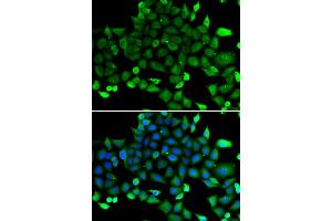 Immunofluorescence analysis of A549 cells using COMMD1 antibody (ABIN5974300).