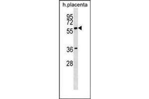 Western blot analysis of GAB3 Antibody (N-term) in human placenta tissue lysates (35ug/lane). (GAB3 antibody  (N-Term))