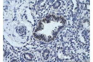 Rabbit Anti-RCOR1 Antibody       Paraffin Embedded Tissue:  Human bronchiole epithelium   Cellular Data:  Epithelial cells of renal tubule  Antibody Concentration:   4. (CoREST antibody  (Middle Region))