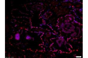 Paraformaldehyde-fixed, paraffin embedded human prostate tissue, Antigen retrieval by boiling in sodium citrate buffer(pH6) for 15min, Block endogenous peroxidase by 3% hydrogen peroxide for 30 minutes, Blocking buffer (normal goat serum) at 37°C for 20min, Antibody incubation with Rabbit Anti-DMA/Dmrt1a Polyclonal Antibody, Unconjugated  at 1:500 overnight at 4°C, followed by a conjugated secondary and DAB staining (DMO/Dmrt1a (AA 51-100) antibody)