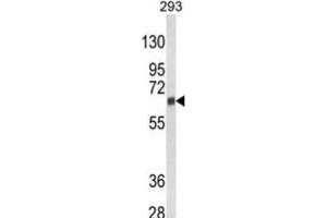 Western Blotting (WB) image for anti-Cytochrome P450, Family 3, Subfamily A, Polypeptide 5 (CYP3A5) antibody (ABIN3003498)