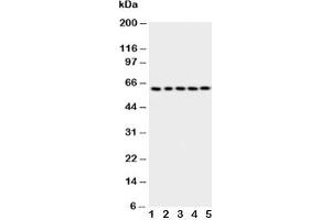 Western blot testing of p63 antbody; Lane 1: HeLa;  2: SMMC-7721;  3: COLO320;  4: A549;  5: SGC cell lysate