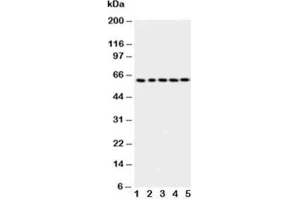 TCP1 alpha/CCTA 抗体  (AA 82-98)