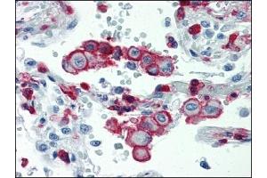Immunohistochemistry (IHC) image for anti-Integrin beta 2 (ITGB2) antibody (ABIN614281) (Integrin beta 2 antibody)