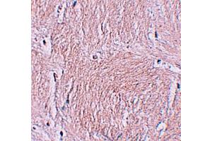 Western blot analysis of ZMYM3 in human brain tissue lysate with ZMYM3 antibody at 1 µg/mL. (ZMYM3 antibody  (C-Term))