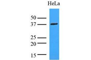 Western Blotting (WB) image for anti-Lactate Dehydrogenase A (LDHA) (AA 1-332), (N-Term) antibody (ABIN492379) (Lactate Dehydrogenase A antibody  (N-Term))