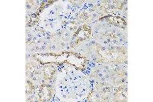 Immunohistochemistry (IHC) image for anti-B9 Protein Domain 1 (B9D1) antibody (ABIN2736339)