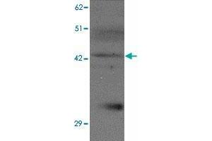 Western blot analysis of SLC39A13 in K-562 cell lysate with SLC39A13 polyclonal antibody  at 1 ug/mL.