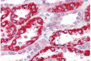Human Kidney: Formalin-Fixed, Paraffin-Embedded (FFPE) (OCIAD2 antibody  (N-Term))