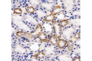 Immunohistochemistry analysis of paraffin-embedded rat kidney using,GAA1 (ABIN7074122) at dilution of 1: 4000 (GPAA1 antibody)