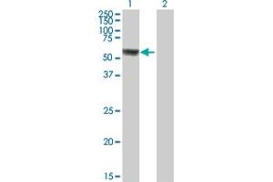 Western Blot analysis of ACSF3 expression in transfected 293T cell line by ACSF3 MaxPab polyclonal antibody.