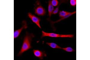 Immunocytochemistry staining of A431 cells with alpha-Tubulin monoclonal antibody, clone RM113  (Red) at 1:200 dilution.