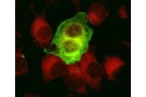 Immunofluorescence (IF) image for anti-Herpes Simplex Virus Type 1, Glycoprotein C (HSV1 gC) antibody (ABIN265558) (HSV-1 gC antibody)