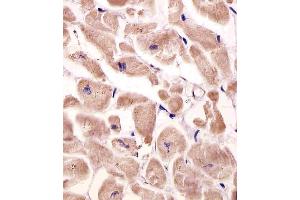 Antibody staining VLDLR in human heart tissue sections by Immunohistochemistry (IHC-P - paraformaldehyde-fixed, paraffin-embedded sections). (Very Low Density Lipoprotein (VLDL) (AA 484-510) antibody)
