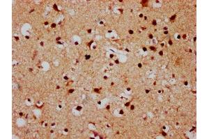 IHC image of ABIN7152883 diluted at 1:500 and staining in paraffin-embedded human brain tissue performed on a Leica BondTM system. (FSD1 antibody  (AA 251-370))
