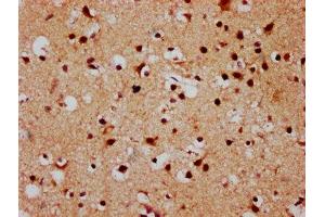 IHC image of ABIN7152883 diluted at 1:500 and staining in paraffin-embedded human brain tissue performed on a Leica BondTM system.