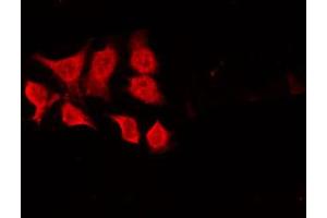 ABIN6268645 staining HeLa by IF/ICC. (CHEK1 antibody  (Internal Region))