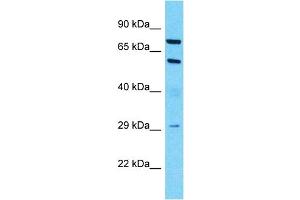 Host:  Rabbit  Target Name:  MUC13  Sample Type:  Lymph Node Tumor lysates  Antibody Dilution:  1.